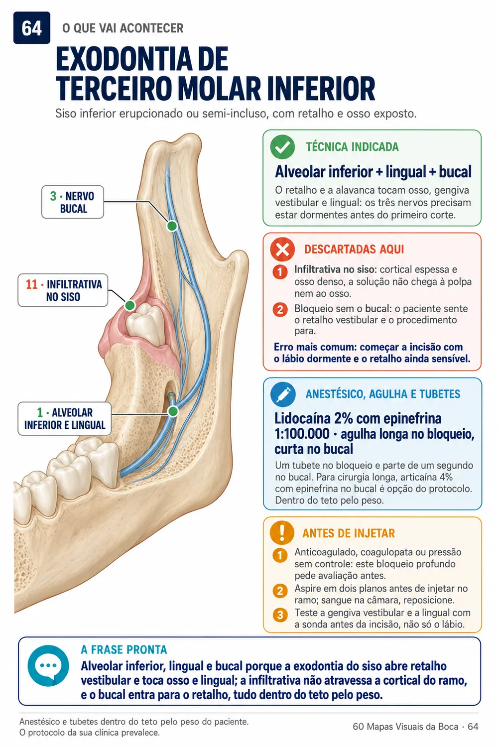 Cruzamento: exodontia de terceiro molar